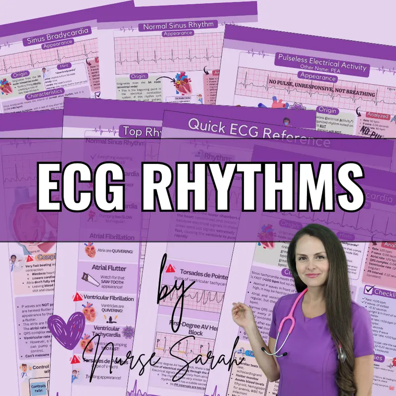 ECG Rhythm Study Sheets for Nurses